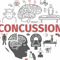 concussion graphics